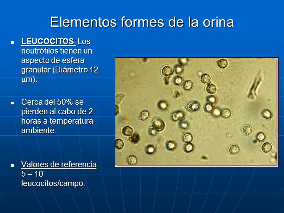 valor referencial de leucocitos en orina